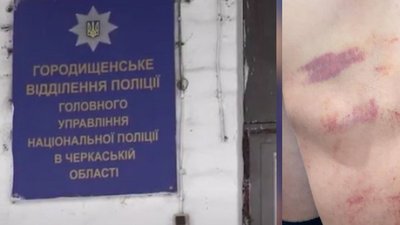 У Черкасах судитимуть поліцейських за катування громадянина