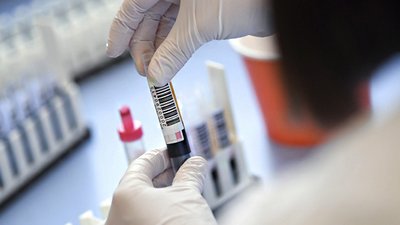В Одеській області за добу COVID-19 підтвердили у 25 людей