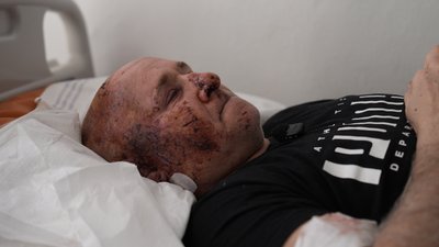 Поранений через удар по Сумах 22 жовтня