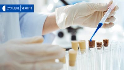 На Чернігівщині ще 2 підтверджених випадки захворювання на коронавірус