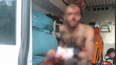 Чоловік, якому відірвало частину руки біля Слатиного