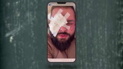 Такий вигляд мав Артем Ракітін 24 жовтня у госпіталі Такий вигляд мав Артем Ракітін 24 жовтня у госпіталі