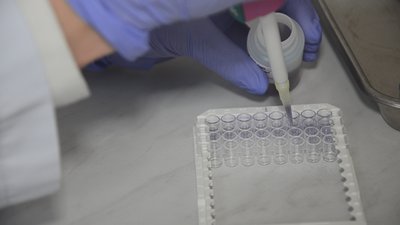 У Тернополі почали тестувати на антитіла до COVID-19 У Тернополі почали тестувати на антитіла до COVID-19