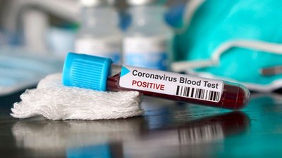 На Херсонщині за останню добу зафіксовано 43 нових випадки захворювання на COVID-19