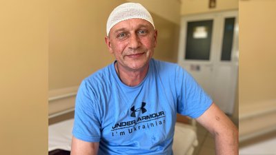Планував їхати на фронт. Львівські хірурги видалили 53-річному чоловіку пухлину мозку