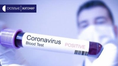 На Житомирщині за добу коронавірус підтвердили в 118 жителів
