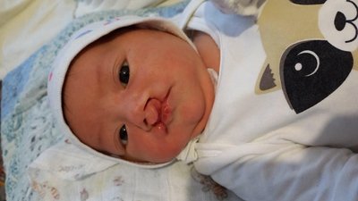 Емілія до операції Емілія до операції