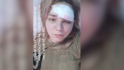 Отримала інвалідність через два роки. Франківка Олександра Клюба оскаржує в суді лікарську недбалість Отримала інвалідність через два роки. Франківка Олександра Клюба оскаржує в суді лікарську недбалість