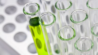 У Кіровоградській області зафіксували ще два випадки COVID-19