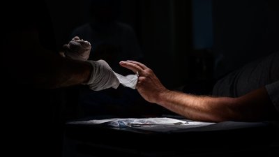 Військовий госпіталь, клініка болю, фантомні болі, ампутація, лікування, Франківськ