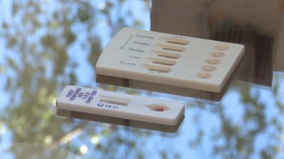 У Сумській клініці, дружній до молоді, показали процес тестування на ВІЛ У Сумській клініці, дружній до молоді, показали процес тестування на ВІЛ