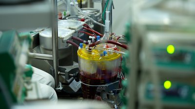 У Чернігові провели операцію на відкритому серці разом з фахівцями інституту Амосова У Чернігові провели операцію на відкритому серці разом з фахівцями інституту Амосова