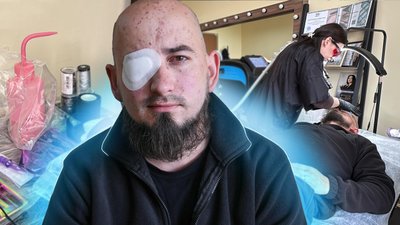 Видалення пороху на тілі