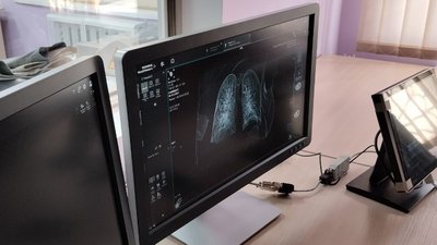 Новий комп'ютерний томограф вартістю один мільйон доларів випробовують в обласній лікарні у Житомирі Новий комп'ютерний томограф вартістю один мільйон доларів випробовують в обласній лікарні у Житомирі