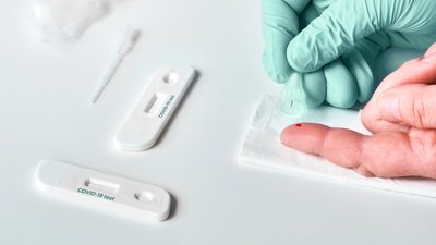 На Чернігівщині коронавірус діагностували у однієї людини. 8 одужали