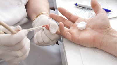 Вірусні гепатити та ВІЛ: експерти розповіли, кому слід пройти тестування