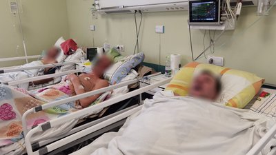 На Полтавщині зросла кількість інсультів: як розпізнати хворобу