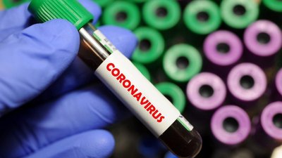 COVID-19: на Херсонщині 69 нових випадків, в Україні +5992