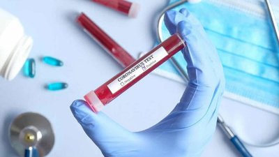 За добу на Дніпропетровщині зареєстровали 302 нових випадки коронавірусу