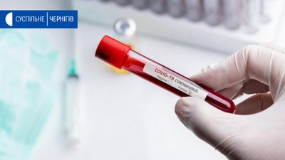 На Чернігівщині - ще три випадки коронавірусу