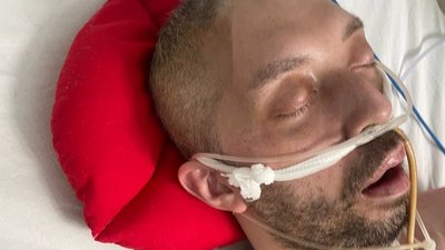 ТЦК, кома, Дніпро, Сергій Кустодєєв