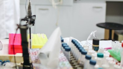 За добу на Миколаївщині на COVID-19 захворіло 12 людей, одужала одна людина За добу на Миколаївщині на COVID-19 захворіло 12 людей, одужала одна людина