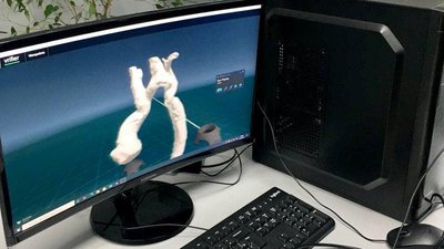 Львівські лікарі виконали операцію за допомогою методики віртуальної реальності Львівські лікарі виконали операцію за допомогою методики віртуальної реальності