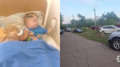 ДТП з ТЦК на Одещині, ТЦК наїхало на дитину
