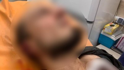 У Черкасах працівник шиномонтажу стріляв у чоловіків У Черкасах працівник шиномонтажу стріляв у чоловіків