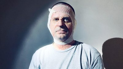 Виліз з палаючої БМП за мить до вибуху: у Львові лікують військового з 30% опіків тіла