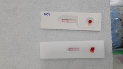 Так виглядає негативний результат тесту на ВІЛ, фото: Суспільне Донбас