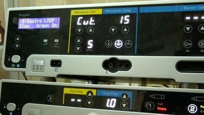 Швидке і безболісне обстеження: черкаська лікарня отримала нові ендоскопічні системи Швидке і безболісне обстеження: черкаська лікарня отримала нові ендоскопічні системи