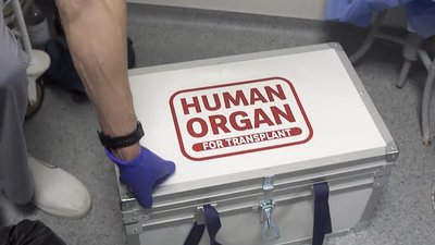11 років на діалізі або раптовий дзвінок серед ночі. Як на Франківщині проводять трансплантації 11 років на діалізі або раптовий дзвінок серед ночі. Як на Франківщині проводять трансплантації