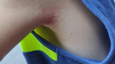 Дитина провалилася в яму в Ужгороді