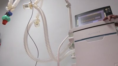 Харківським лікарням передали 14 апаратів ультразвукової діагностики