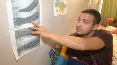 лікування військових