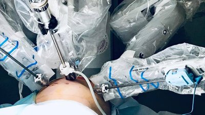 У львівській лікарні вперше провели операцію із допомогою робота У львівській лікарні вперше провели операцію із допомогою робота