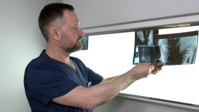 Як працює центр ортопедії, травматології та артроскопії на Волині Як працює центр ортопедії, травматології та артроскопії на Волині