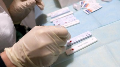 В Ужгороді охочих безкоштовно тестуватимуть на вірусні гепатити та ВІЛ