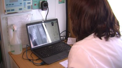У центрі Луцька безплатно обстежували людей на пересувному флюорографі
