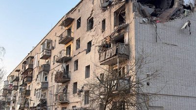 Померла 29-річна жінка, яка зазнала тяжких поранень внаслідок обстрілу Шостки