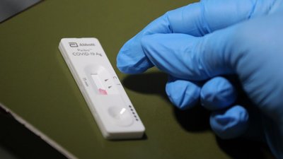 Експрес-тести на COVID-19 на Дніпропетровщині: комунальні заклади отримали, лікарі-ФОПи – чекають