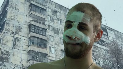 Травмований внаслідок обстрілу Запоріжжя 8.01.2024