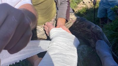 На ношах з Говерли зі зламаною ногою знесли нардепа На ношах з Говерли зі зламаною ногою знесли нардепа