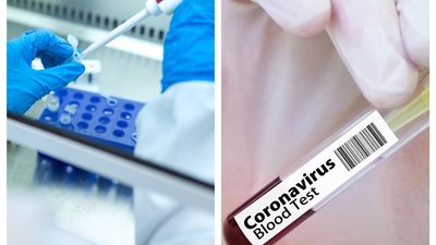 На Хмельниччині плюс 11 інфікованих COVID-19