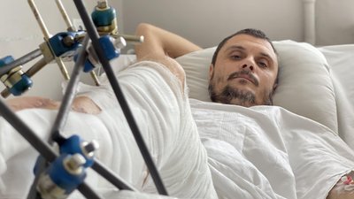 Був ризик ампутації. У Львові команда хірургів врятувала ногу 40-річному пацієнту