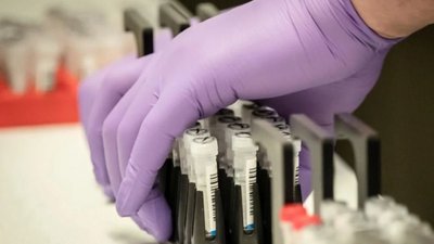 За добу на Дніпропетровщині виявили 6 нових випадків коронавірусної інфекції