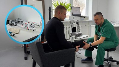 3D заміри: у Полтаві на базі обласної лікарні діє мікроклініка протезування