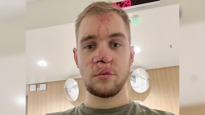 Олександру Петрову зробили операцію в Австрії