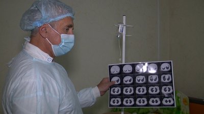 "Щодня заповнена на 90-95%". Як лікують COVID-19 у Хмільницькій районній лікарні на Вінниччині "Щодня заповнена на 90-95%". Як лікують COVID-19 у Хмільницькій районній лікарні на Вінниччині